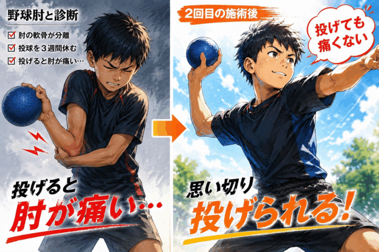 「3週間安静にしても投げると痛い…」野球肘と診断された小学6年生が、再び思い切り投げられるようになるまで